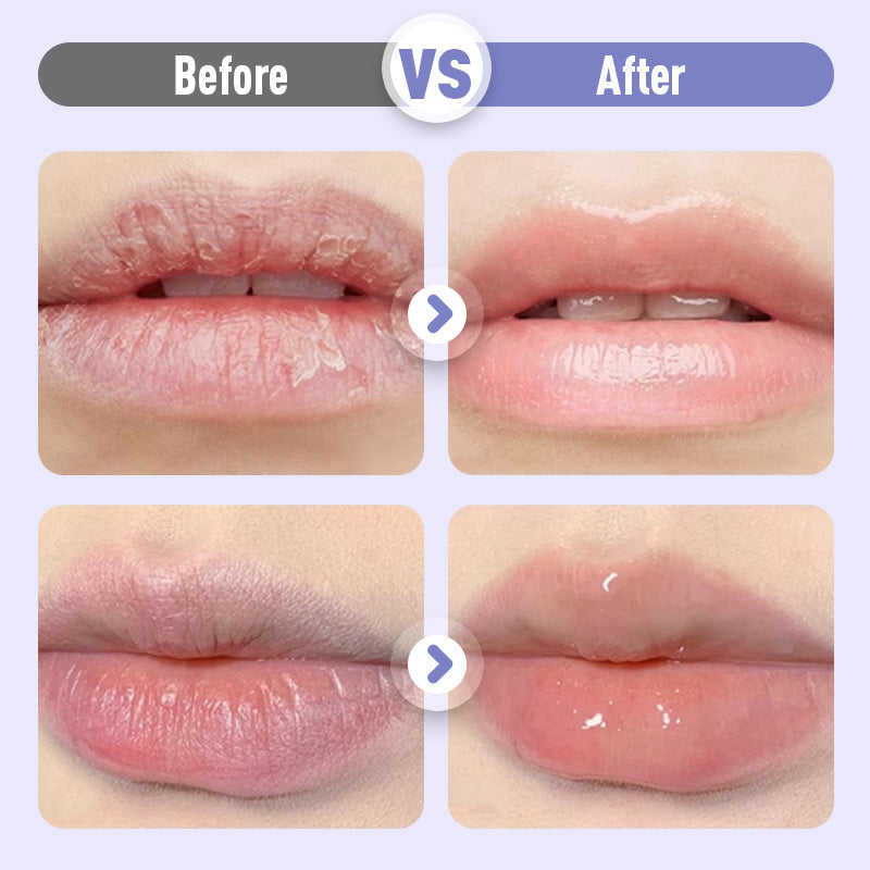 Έντονα θρεπτικό βάλσαμο για τα χείλη